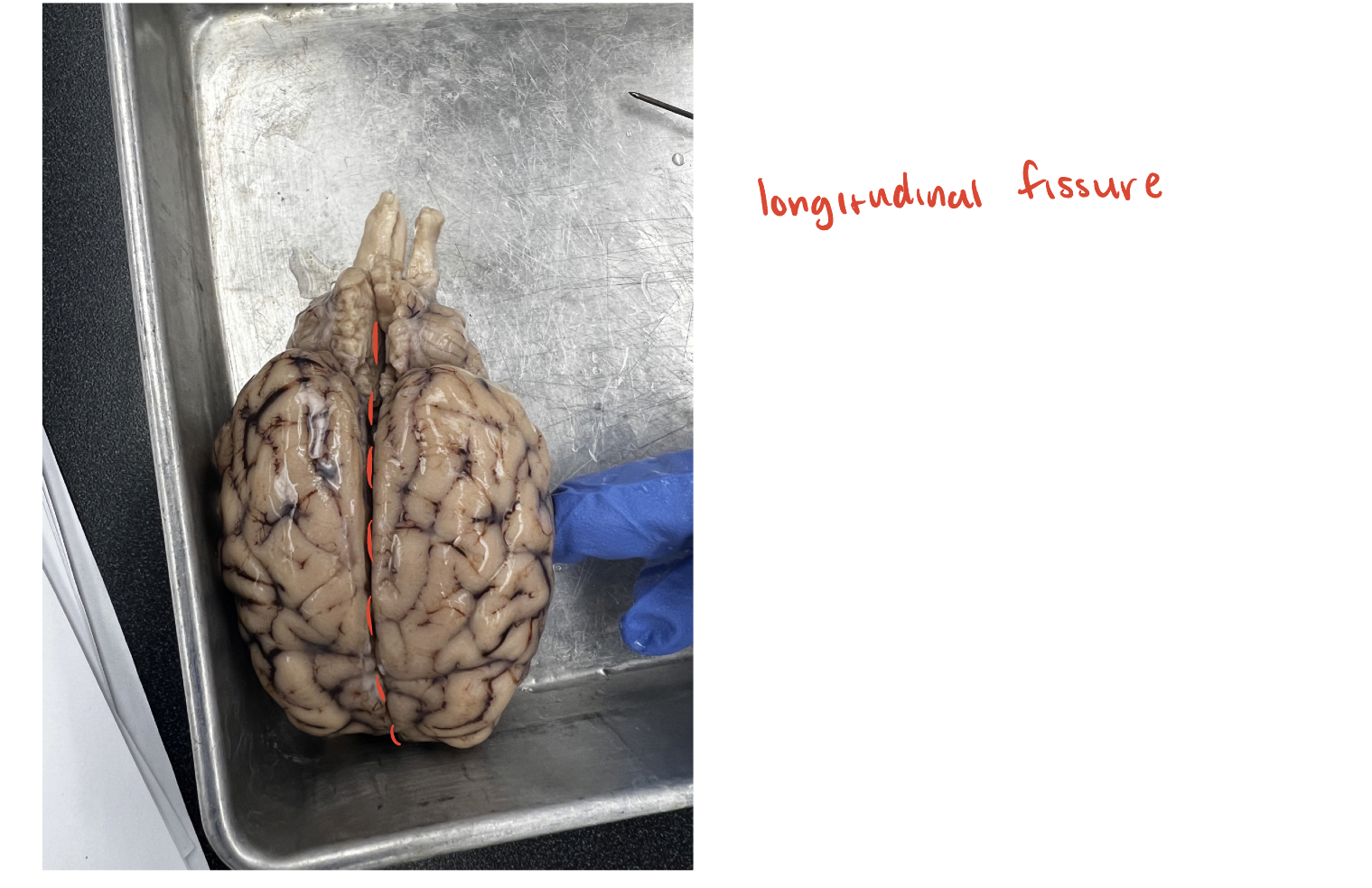 <p>(O) <span>This is the major fissure that runs along the midline of the brain, separating the brain into two hemispheres</span></p>