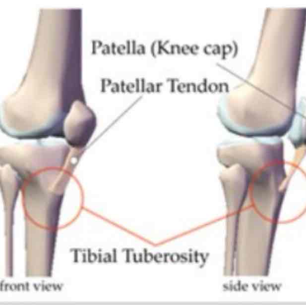 <p>cat #1 / large, rounded projection / tibial tuberosity</p>