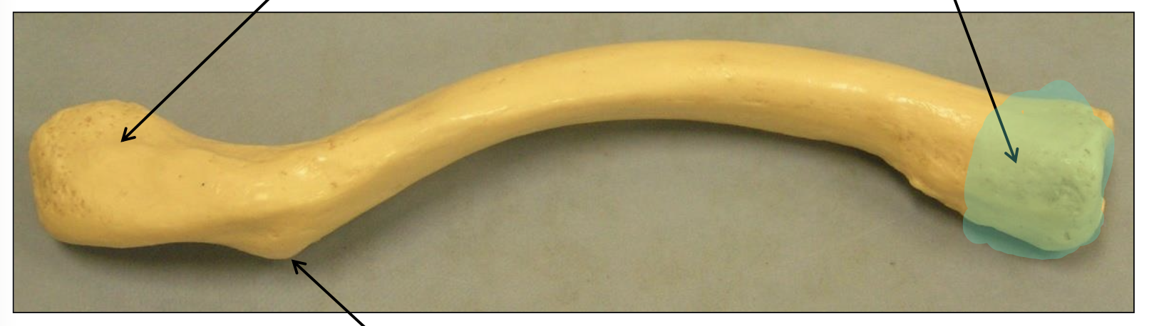 <p>What end of the clavicle is highlighted in this image?</p>