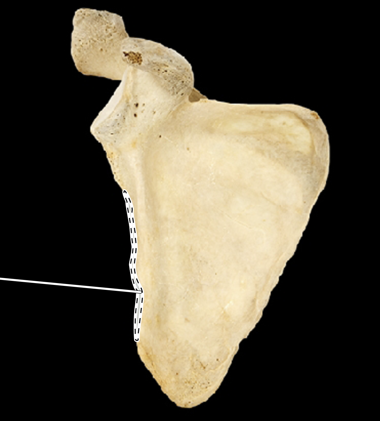 <p>Name the highlighted portion.</p><p>(Anterior view, right side).</p>