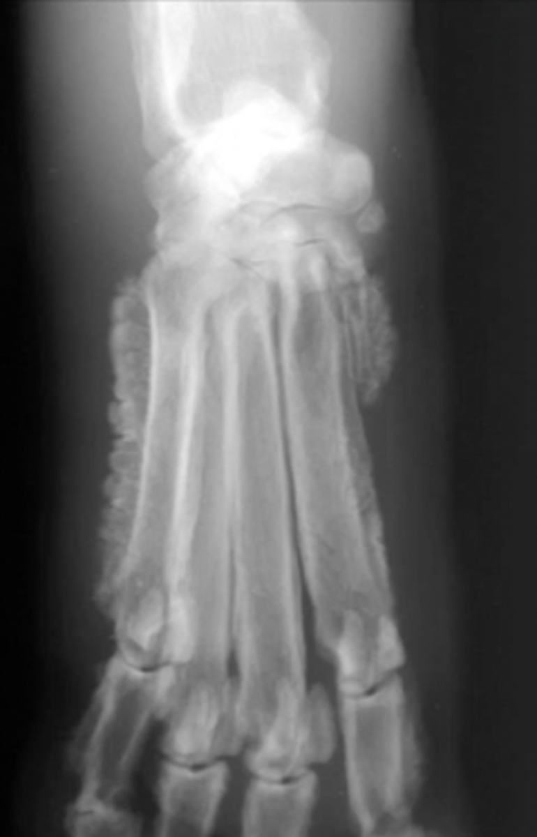 <p>What type of new bone formation is this?</p>