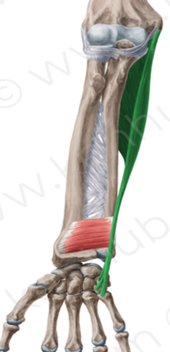 <p>What muscle is this?</p>