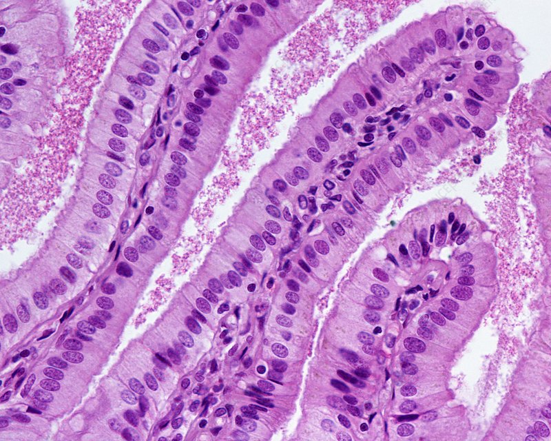 <p>columnar epithelium</p>