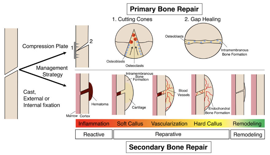 <ul><li><p>gap &gt;1mm: <u>callus</u> formation</p></li><li><p>more common than direct healing and involves endochondral healing</p></li></ul><p>heals in four phases:</p><ol><li><p>Haematoma Phase</p></li><li><p>Inflammatory Phase</p></li><li><p>Reparative Phase</p></li><li><p>Remodelling Phase</p></li></ol><p></p>