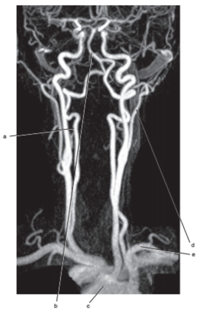 <p>What is letter e ?</p>