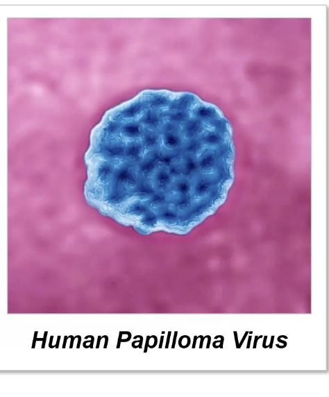 <p>*Polyhedral- Many sided diamond shaped protein package containing nucleic acid</p><p>Ex: Human papilloma virus</p>