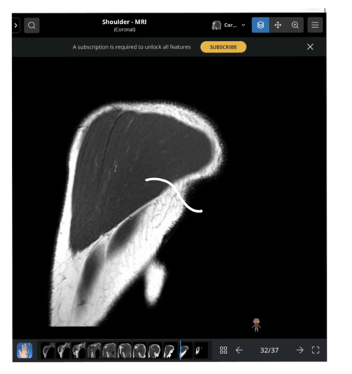 <p>1. What view is this image?</p><p>2. How do you know?</p><p>3. Which structure is being pointed to?</p>