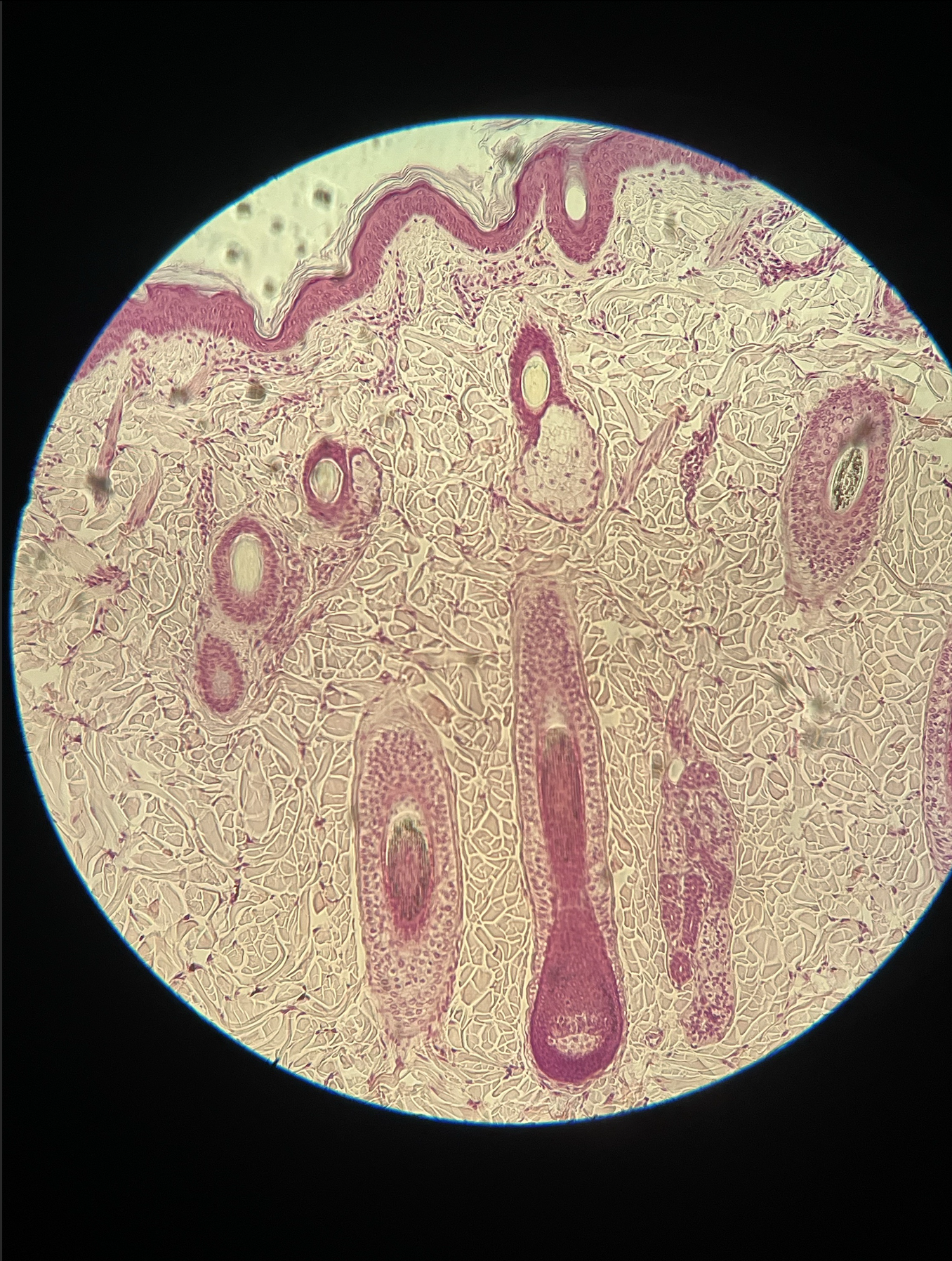 <p>what specimen is this?</p><p>identify the epidermis and hair follicles</p>