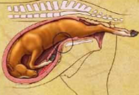 <p>Typically some sort of malpresentation</p>