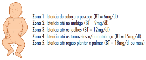 <p>1 cabeça e pescoço <br>2 tronco-umbigo<br>3 umbigo-coxas<br>4 tornozelos e punhos<br>5 palmo-plantar</p>