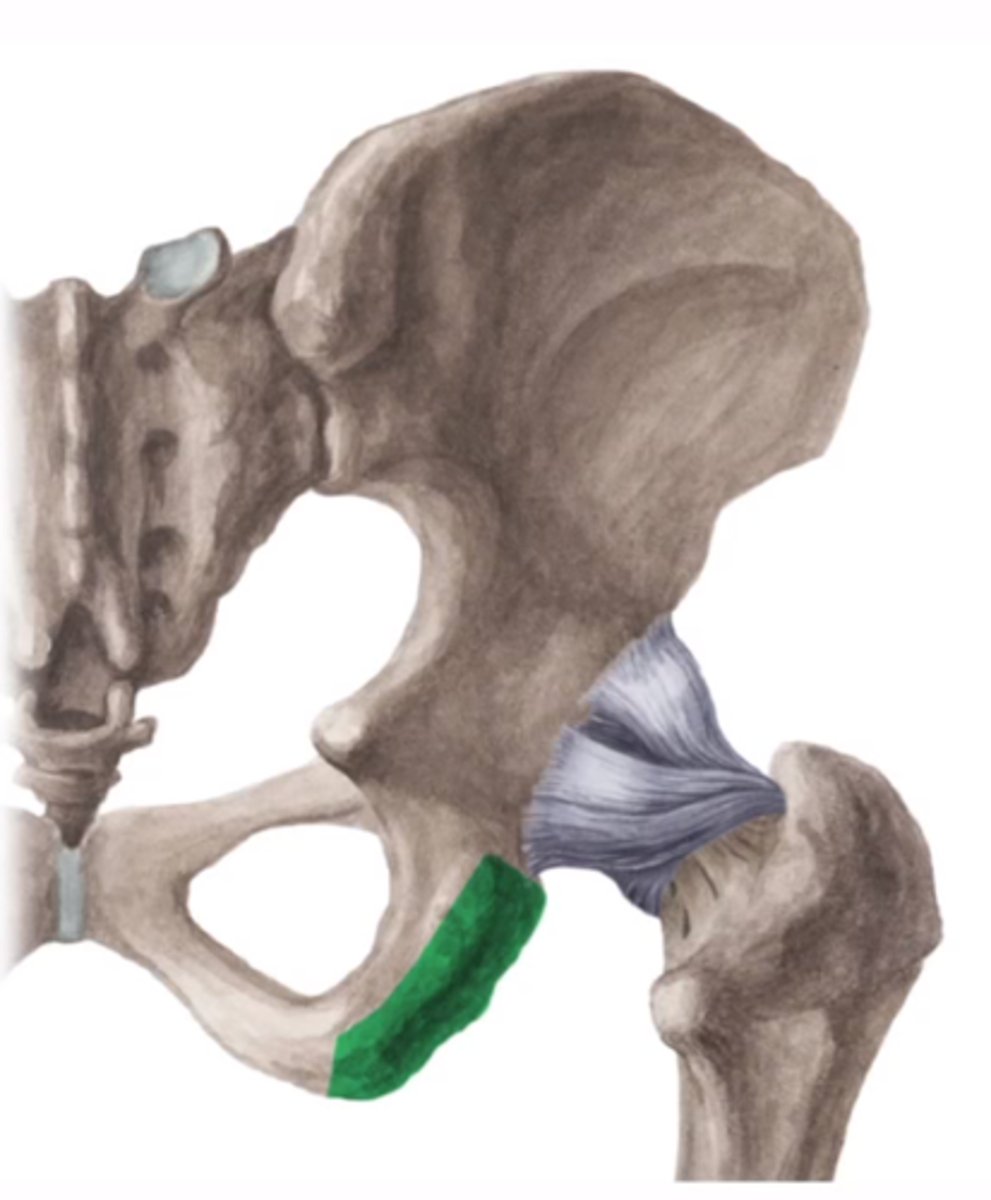 <p>tuber ischiadicum</p>