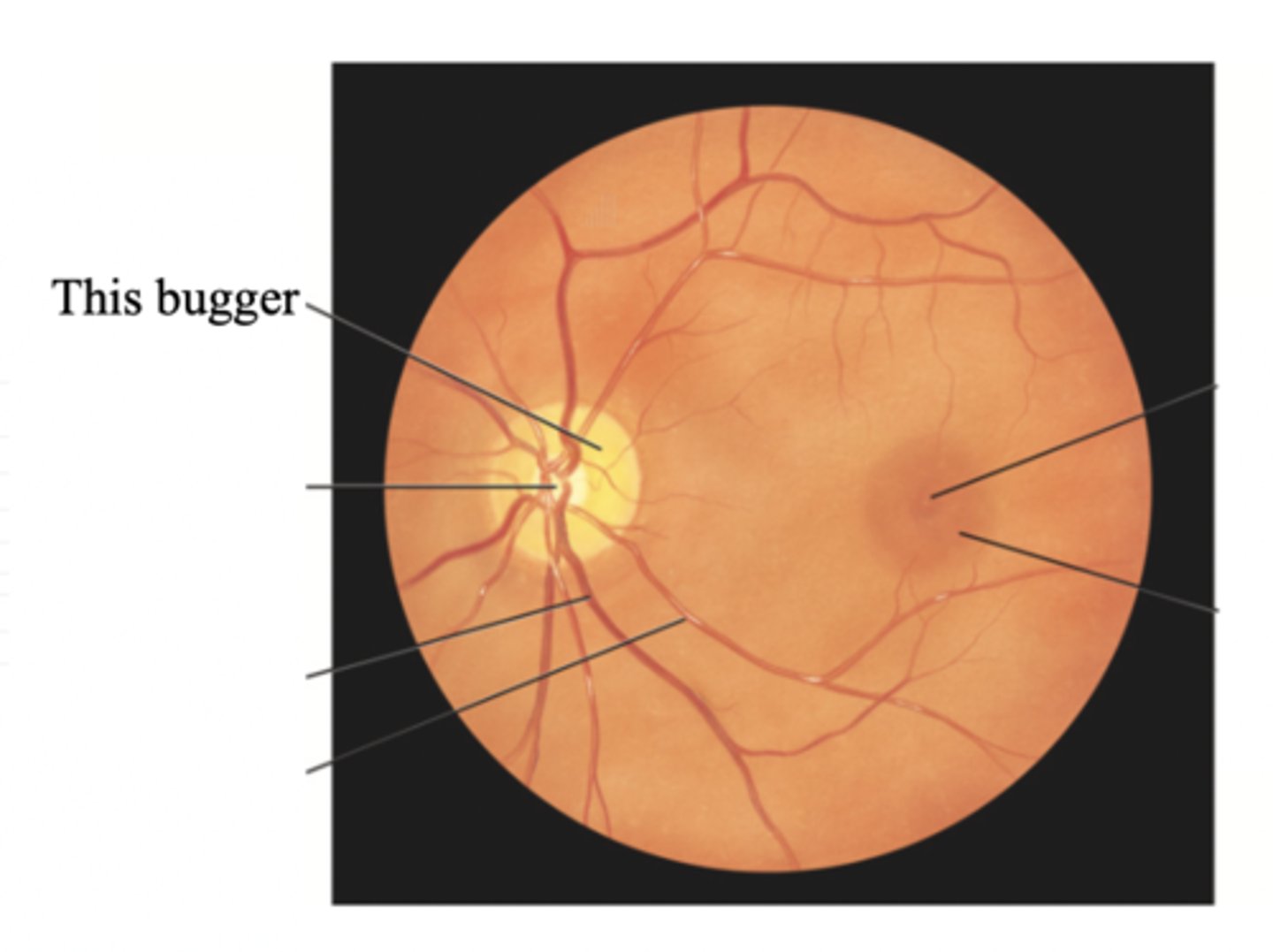 <p>The area in which fibres from the retina converge to form the optic nerve</p>