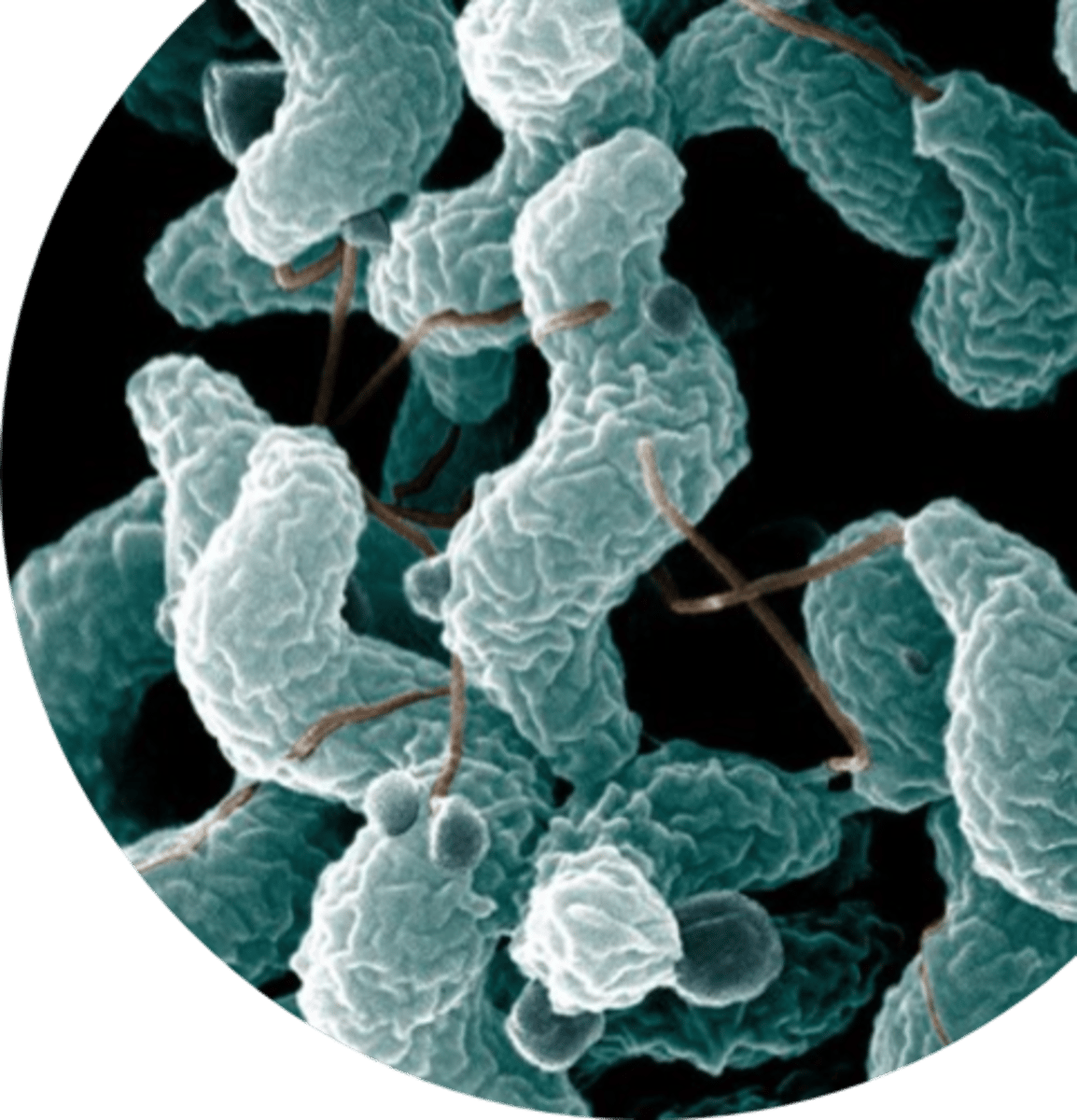 <p>What is the main cause of human bacterial gastroenteritis?</p>