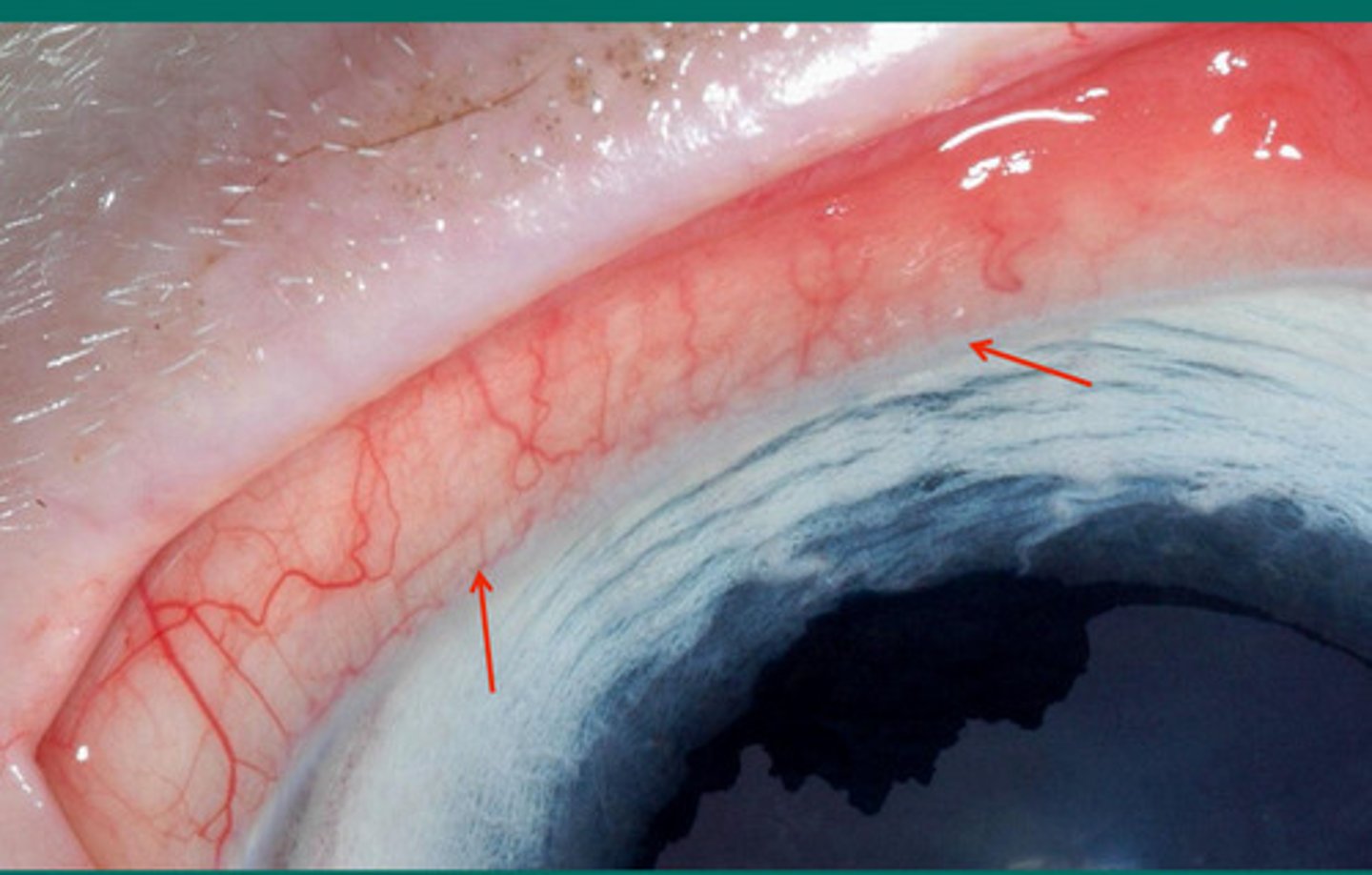 <p>What is the term for where the arrows are pointing?</p>