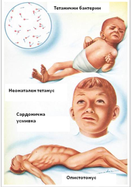 <ul><li><p><span><span>тъкан от рана, кръв, късче от пъпна връв</span></span><br><span><span>при новородено с тетанус</span></span><br></p></li></ul><p></p>