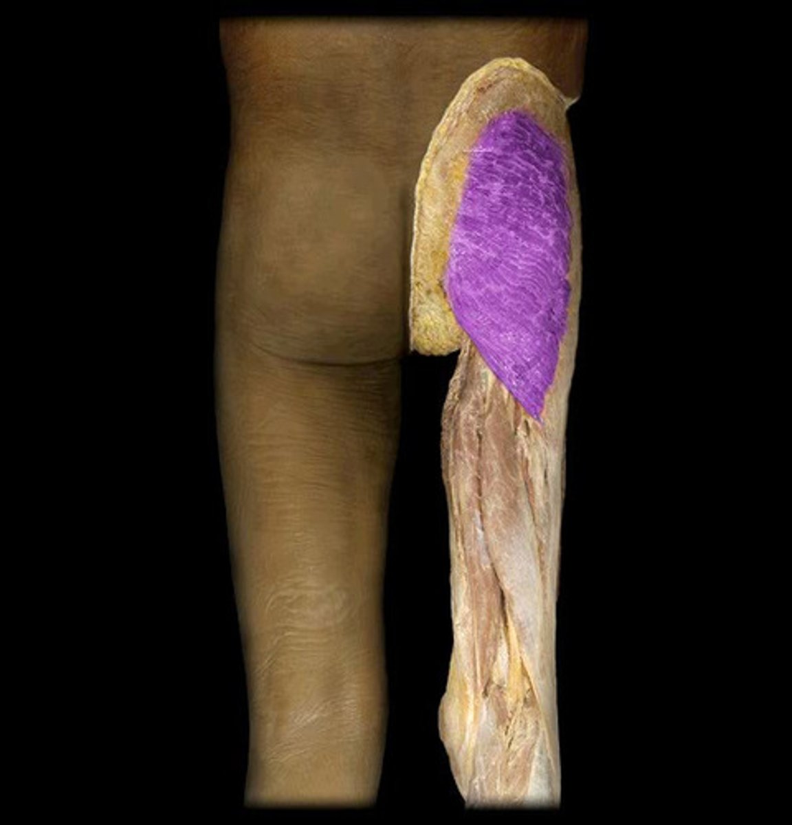 <p>extends thigh</p>