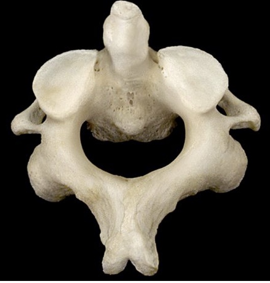 <p>What vertebrae is this?</p>