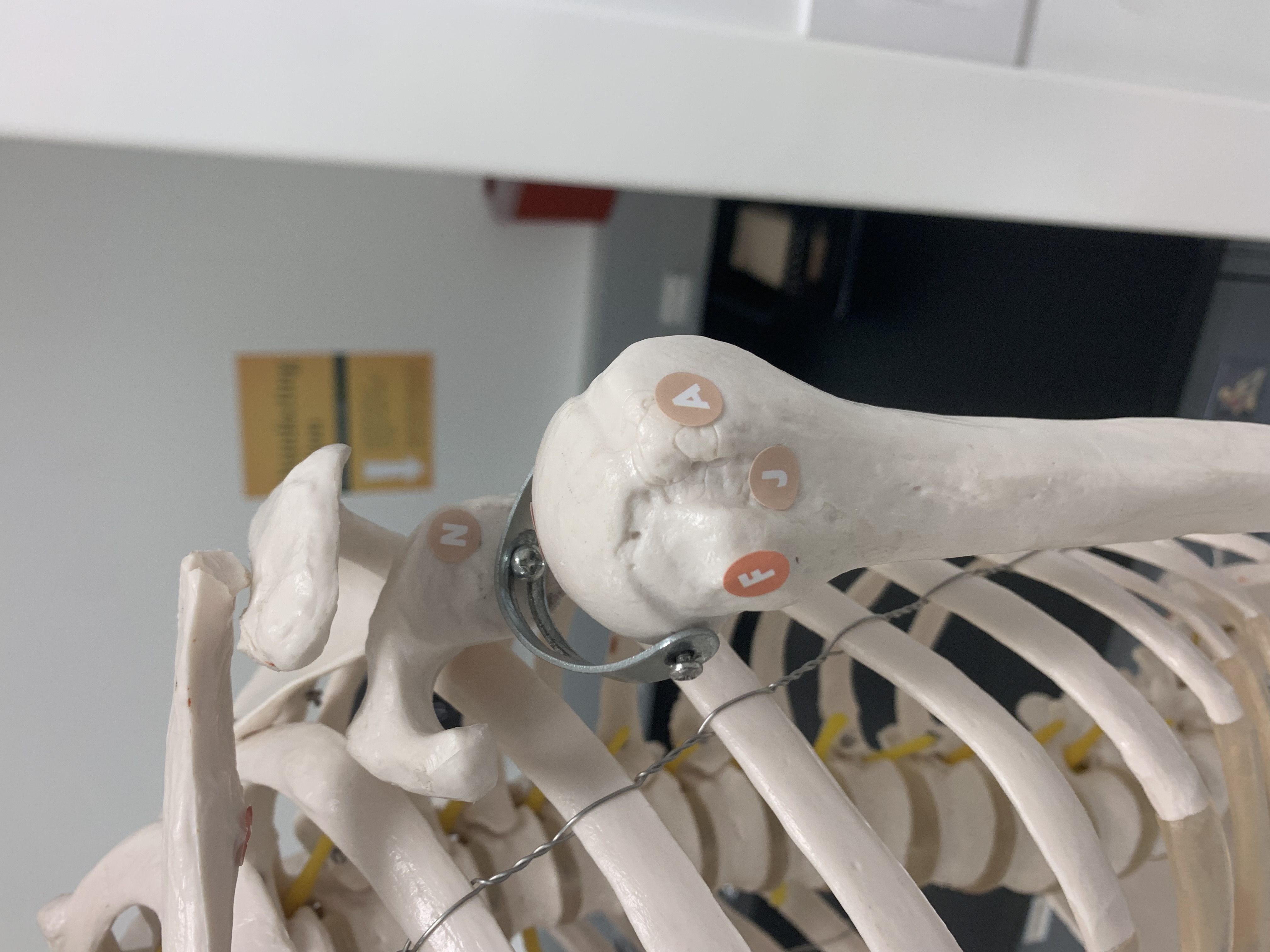 <p>Greater Tubercle</p>