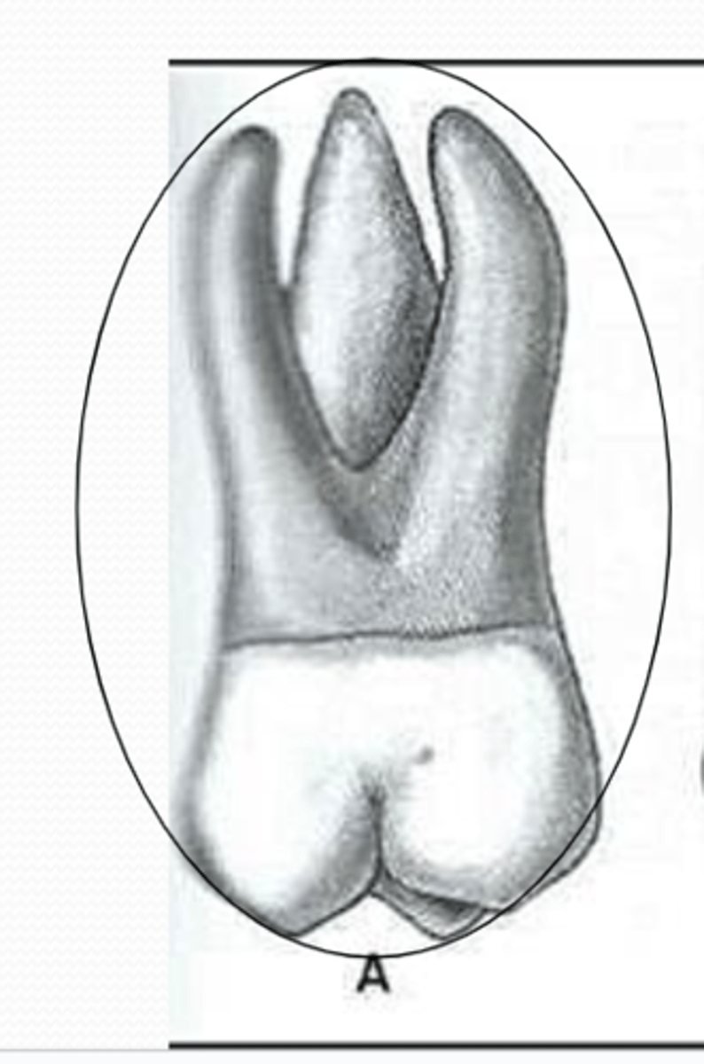 <p>roots are larger and more divergent (further apart) than 2nd and 3rd molars</p><p>"pliers" nickname</p>