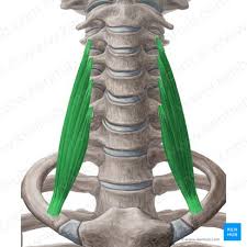 <p>Action: Bilateral flexion, ipsilateral lateral flexion contralateral rotation <strong>of the cervical</strong></p><p>Exercise: Isometric wall flexion</p><p>Stretch: Neck lateral flexion</p>