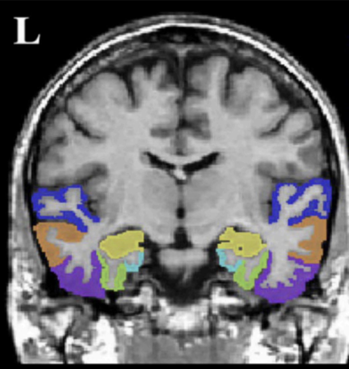 <p>light blue area</p>