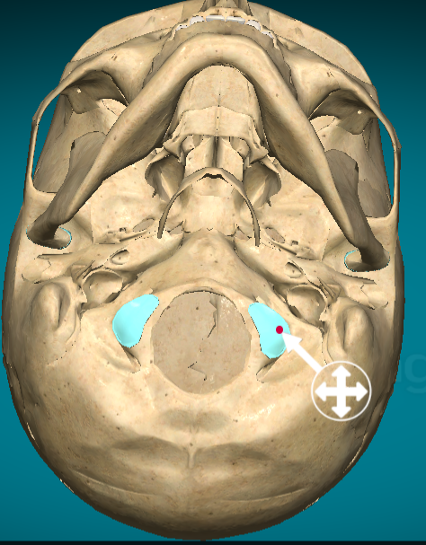 <p>Occipital condyle</p>