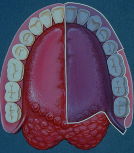 <p>Area of Anesthesia</p><ul><li><p>All mandibular teeth to midline and surrounding periodontium and alveolar</p></li><li><p>Buccal and labial soft tissue anterior to mandibular 1st molar (served by mental nerve)</p></li><li><p>All lingual soft tissue, floor of the mouth,anterior two thirds of the tongue</p></li></ul><p></p>