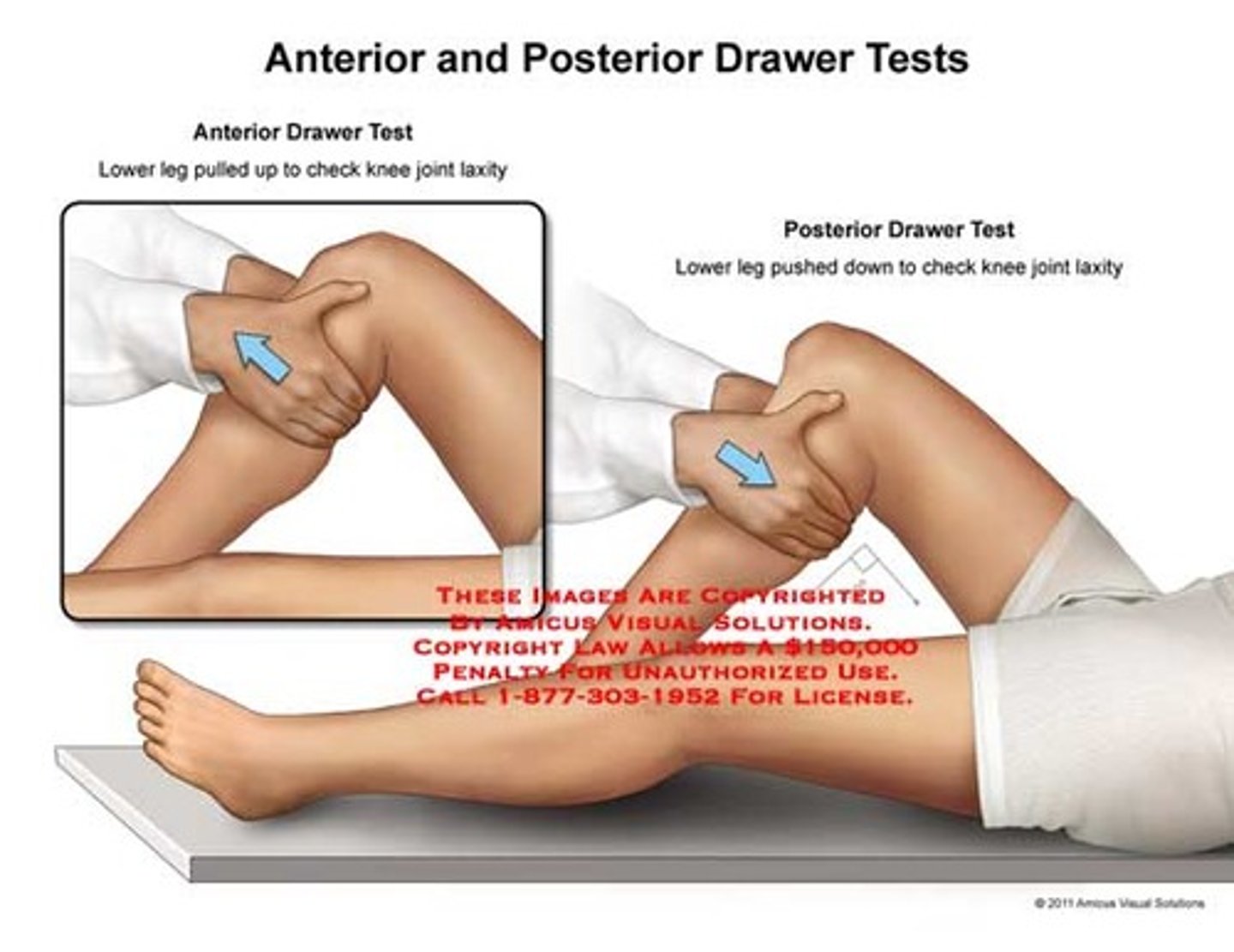 <p>- Passive movement to stress joint stabilizing structures.</p><p>- Test for magnitude of motion and quality of barrier</p><p>- Directionally specific</p>