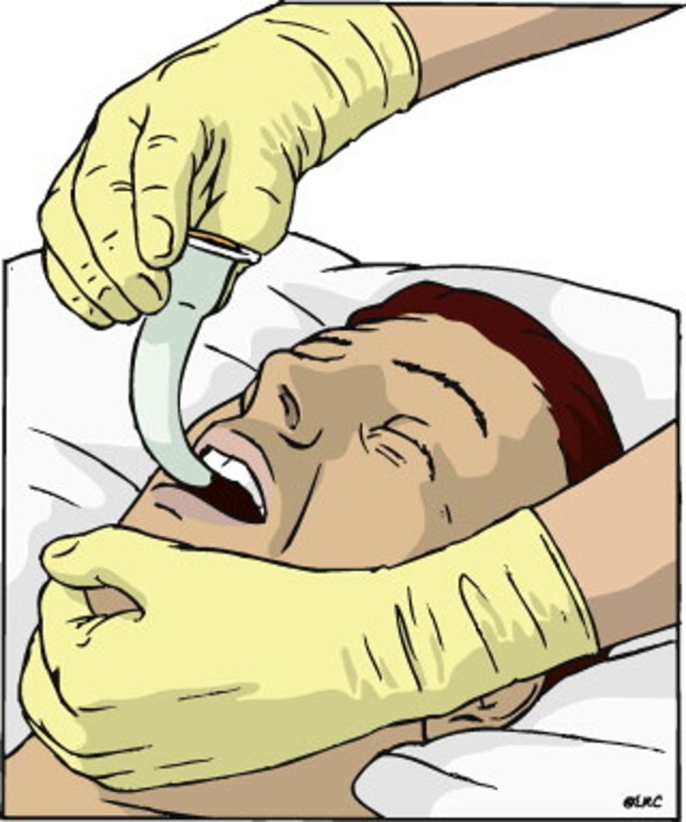 <p>Used for:</p><p>~Unresponsive patients</p><p>~Patients with no gag reflex</p>