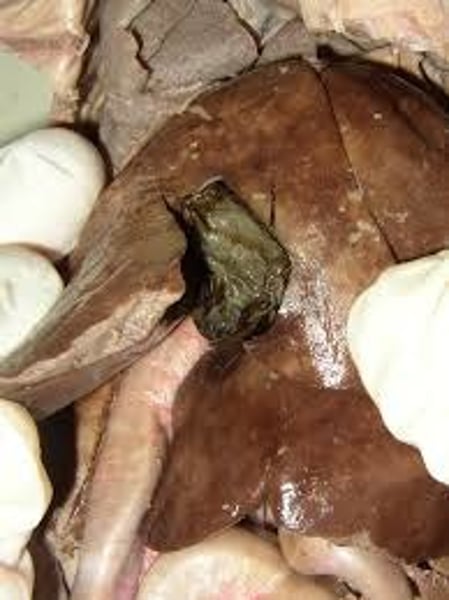 <p>Organ nestled in liver</p>