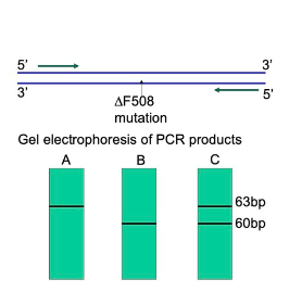 <p><span>A known deleterious mutation on the CTFR gene causing cystic fibrosis (autosomal recessive disease) is a <strong>deletion of 3 bases known as deltaF508</strong>. In the P<strong>CR result shown in the figure, which patient has cystic fibrosis?</strong></span></p><p><span>a) A</span></p><p><span>b) B</span></p><p><span>c) C</span></p>