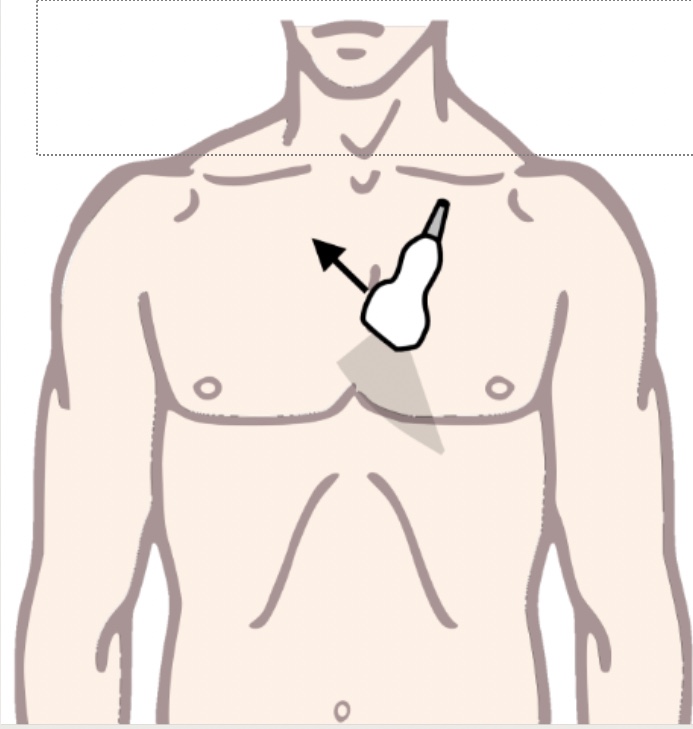 <p>What view is this?</p>