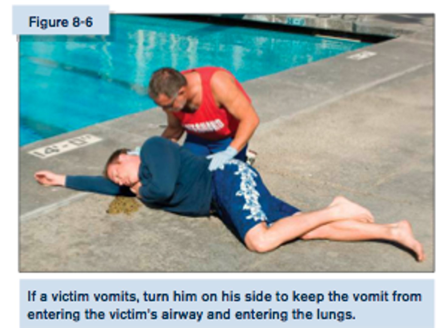 <p>It is common for drowning victims to vomit because water enters the stomach or air has been forced into the stomach during ventilations. If a victim vomits, turn onto side and sweep mouth to clear the airway and prevent the victim from choking</p>