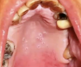 <p>What is the diagnosis?</p>