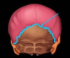 <p>between parietal bones and occipital bone</p>
