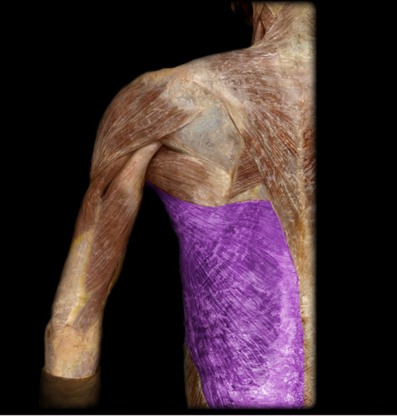 term image