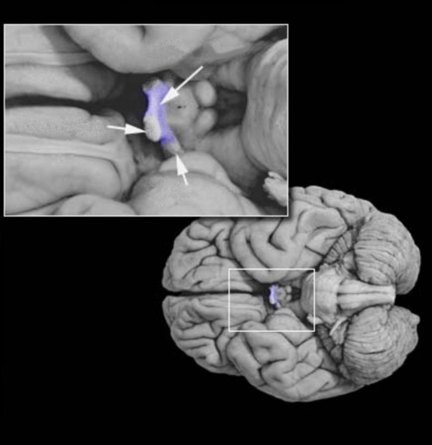 <p>Cranial nerve ll formed by the axons of retinal ganlgion cells that project to targets in the diencephalon and mesencephalon.</p>