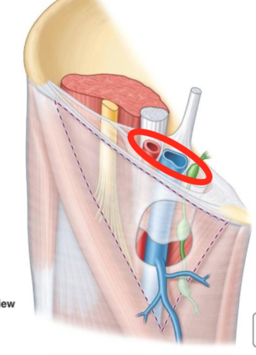 <p>identify this structure</p>