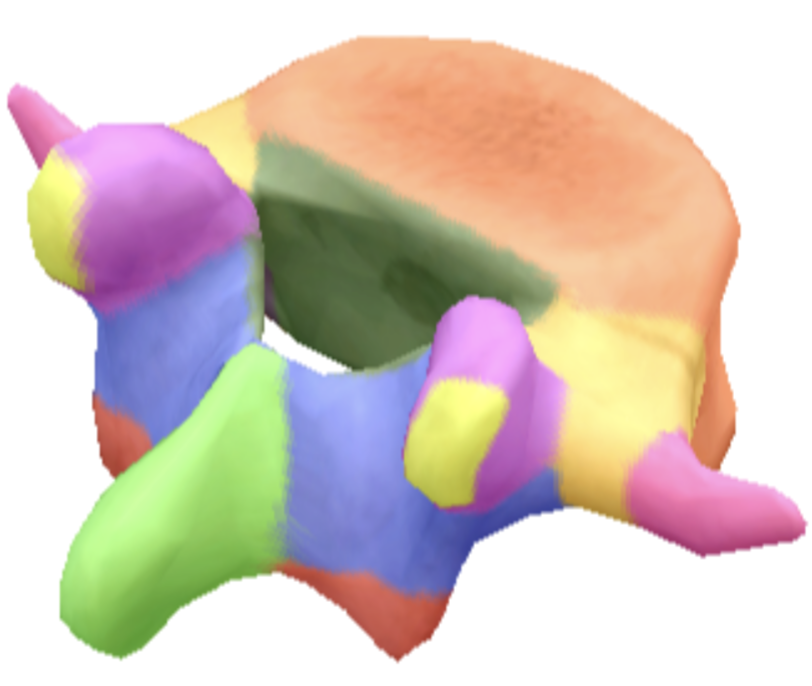 <p>Is this a cervical, thoracic or lumbar bone?</p>