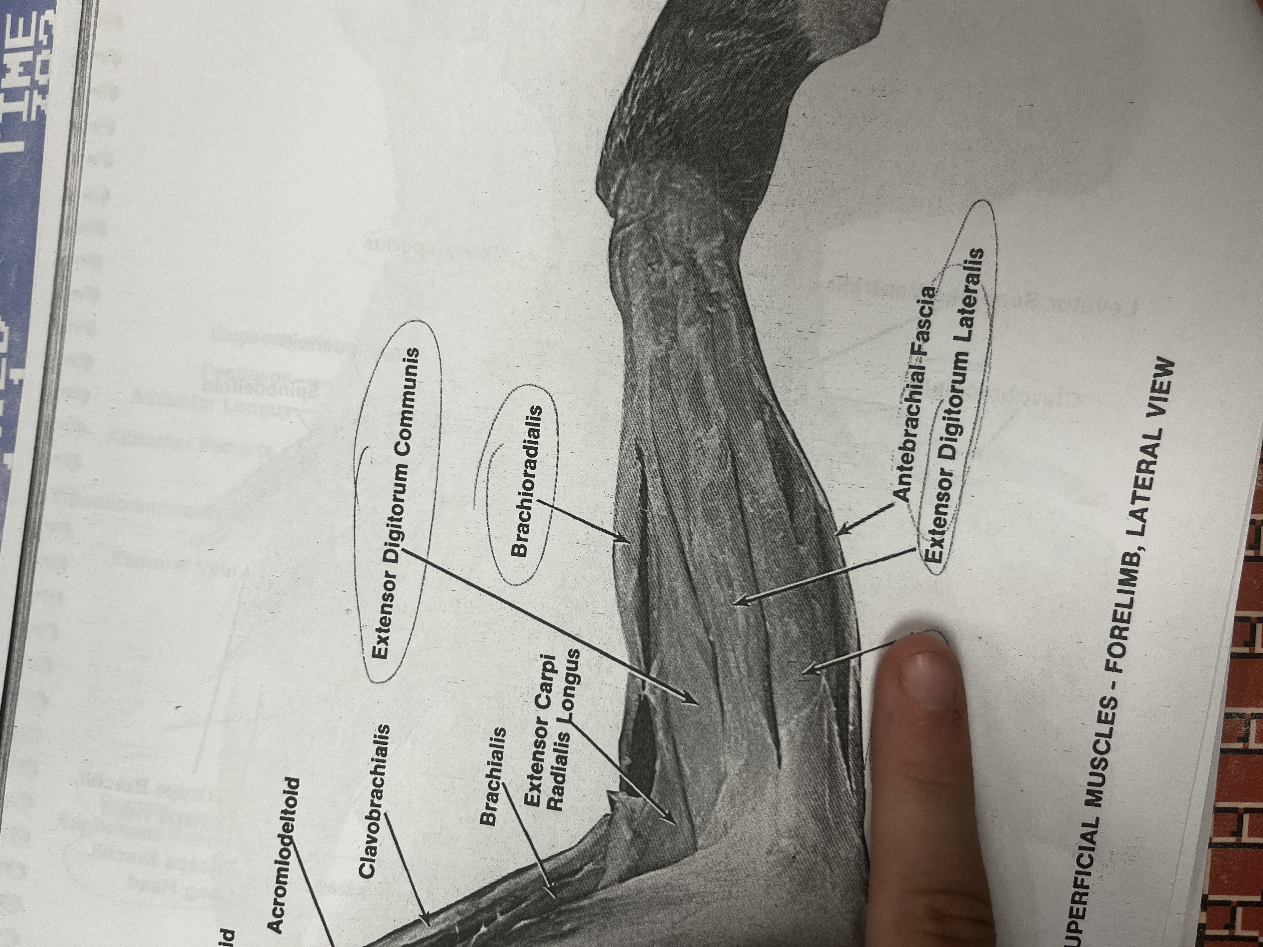 <p>A muscle in the forearm that extends and adducts the wrist.</p>