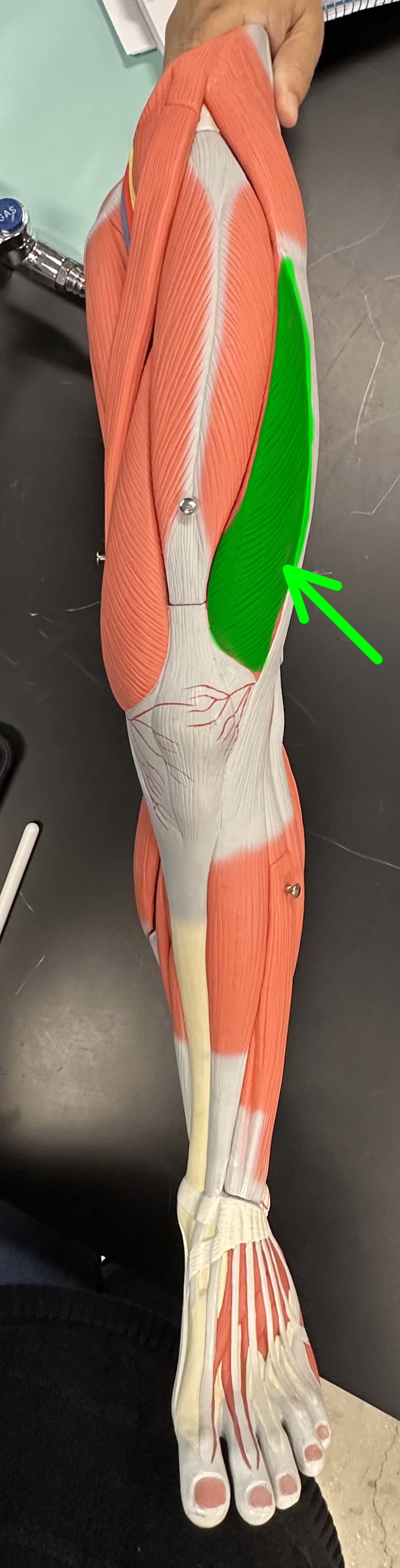 <p>What is the highlighted structure (deep to rectus femoris)</p>
