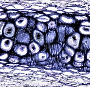 <p>Identify this connective tissue, its location, and its function.</p>