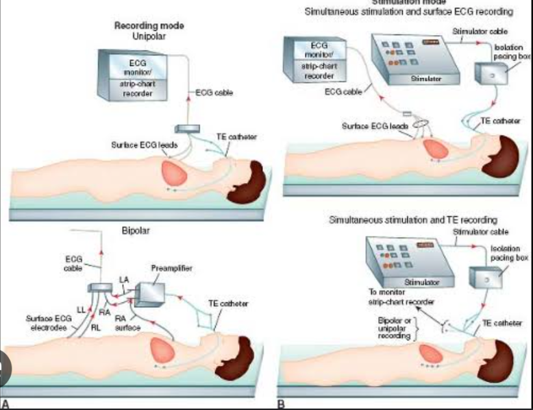 <p>are tests in which special catheters with electrodes are used to stimulate the cardiac tissue to assess the nature and origin of cardiac arrhythmias and the response to antiarrhythmic drug therapy</p>
