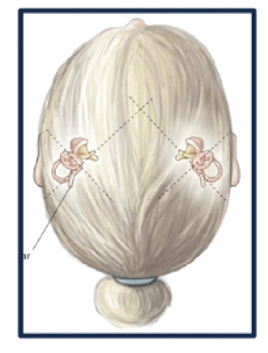 <p>mirror-image orientation of the saccule and utricle on left and right</p><p>when there is excitation on one side of the head, there is inhibition on the other </p>