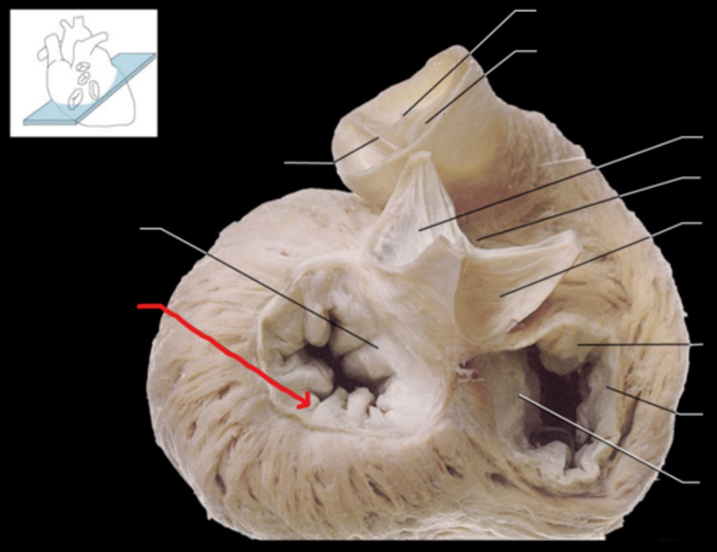 <p>Name the Structure of the Left Ventricle</p>