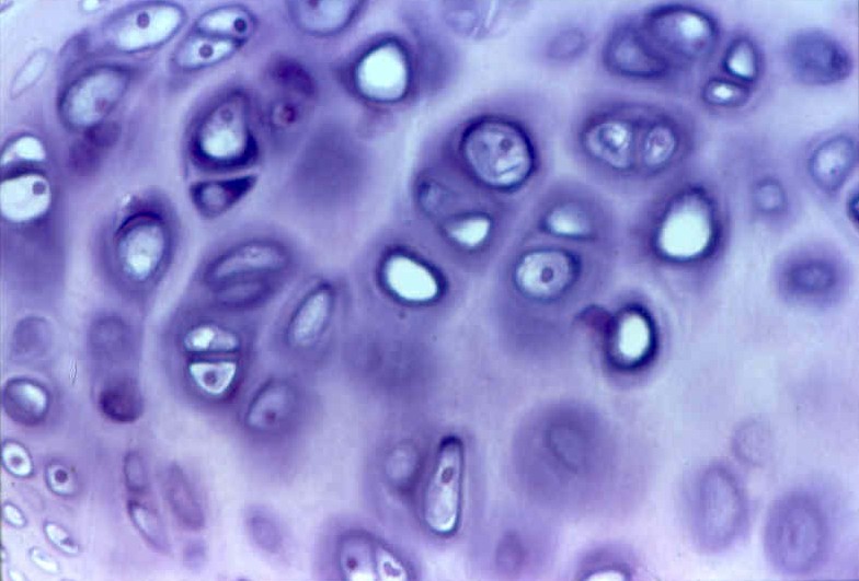 <p>What is the white spaces in this tissue</p>