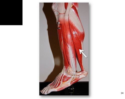 <p>What muscle is this?*****</p>