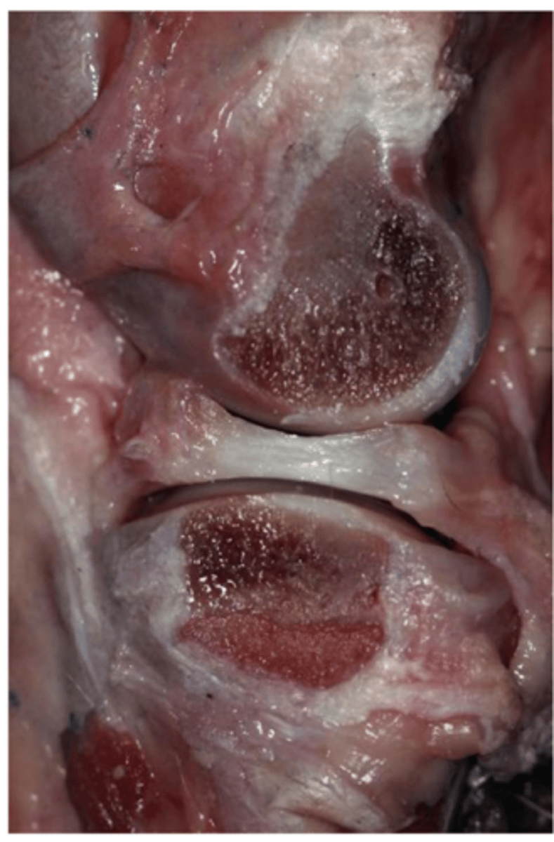 <p>the central 85% of the meniscus is nourished by ____</p>