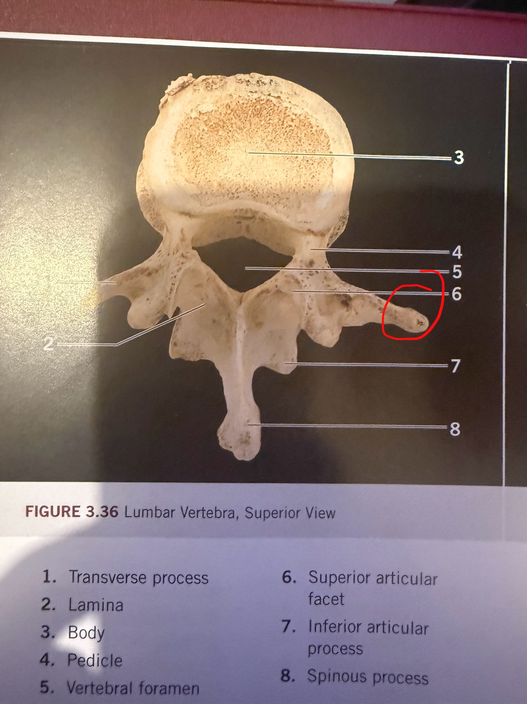 term image
