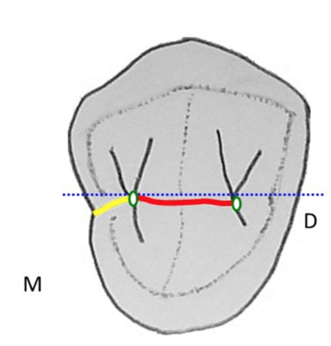 <p>central groove (red line)</p>